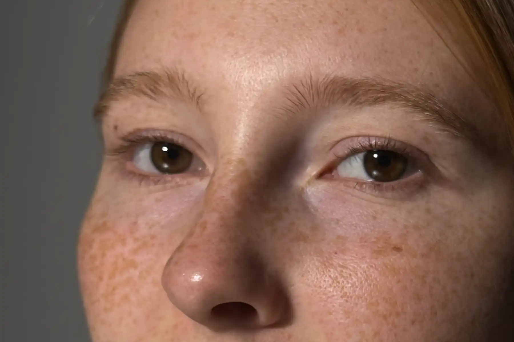 Laminace obočí — před ošetřením v SkinArth Studiu