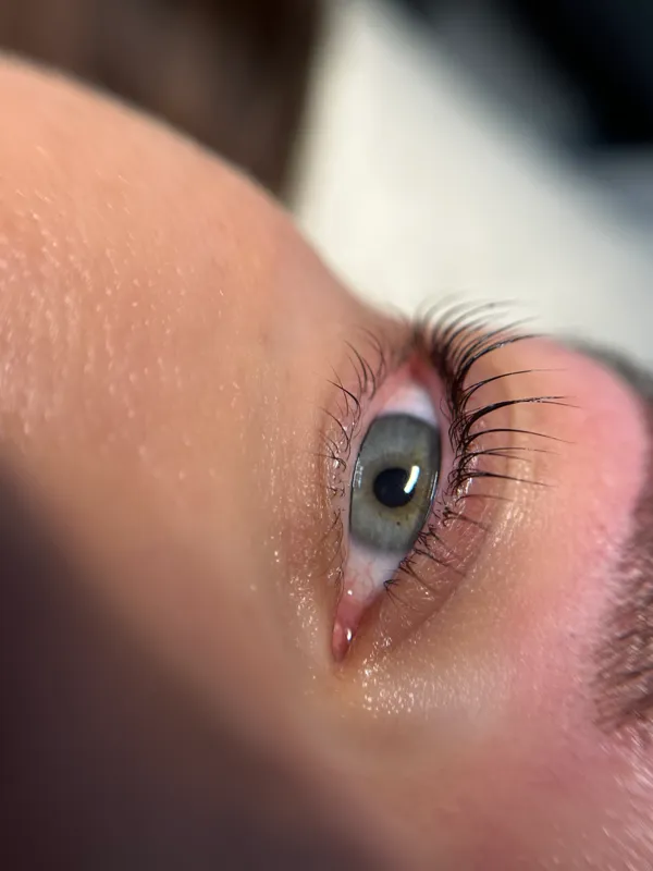 Kosmetická péče — výsledek ošetření SkinArth Studio Praha