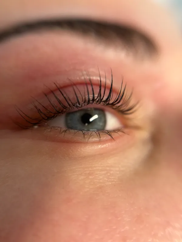 Profesionální ošetření pleti — SkinArth Studio